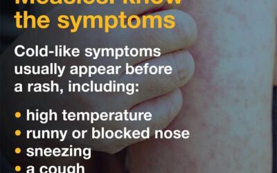 Rise in measles cases